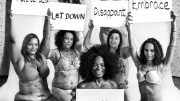 Ilford woman with vitiligo takes part in 'empowering' photoshoot to show 'we can all be beautiful'